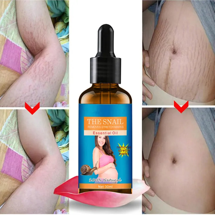 Snail Remove Essential oil - Image 2