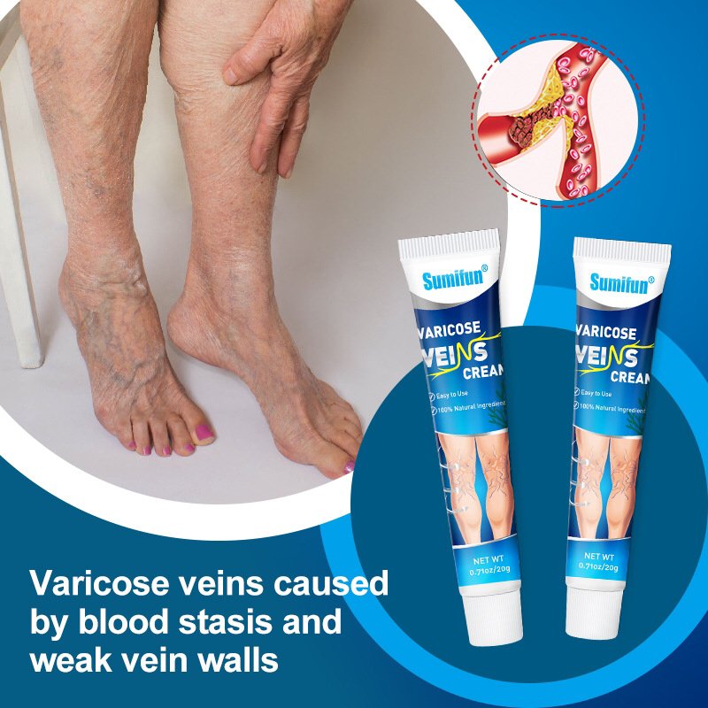 Treat Varicose Green Veins - Image 3
