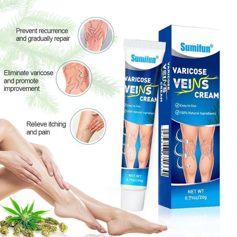 Treat Varicose Green Veins - Image 2