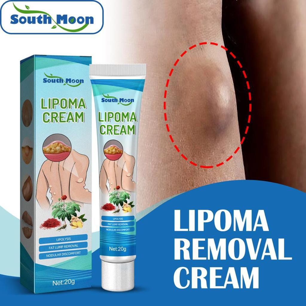 Lipoma Removal