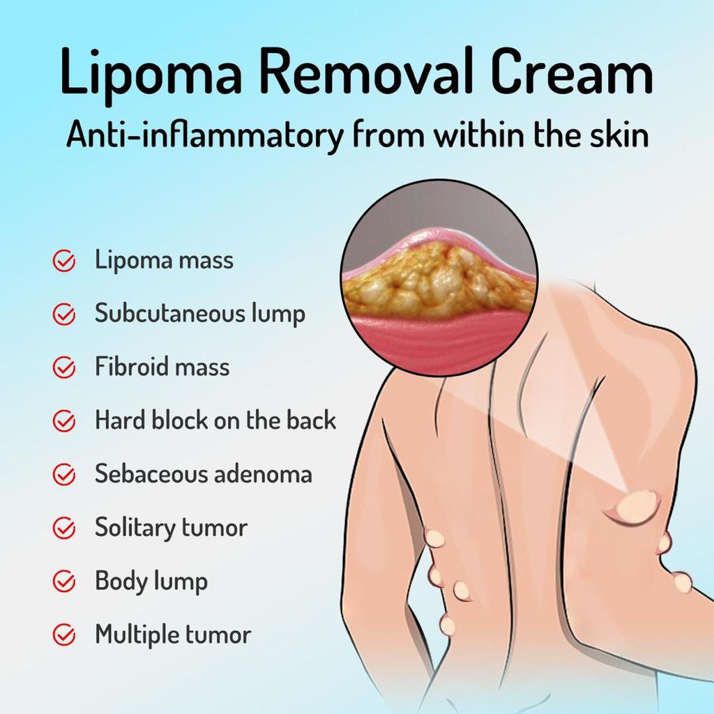 Lipoma Removal - Image 4